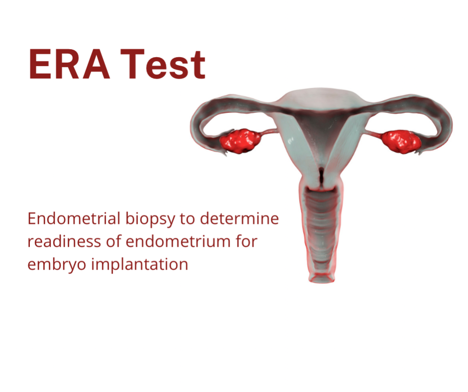 ЕРА тест за ендометриална рецептивност – интересни факти